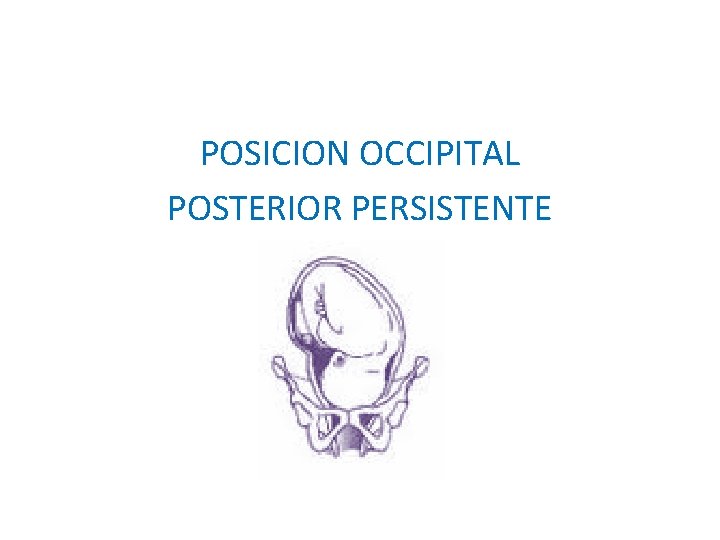 POSICION OCCIPITAL POSTERIOR PERSISTENTE POSICION OCCIPITAL POSTERIOR PERSISTENTE