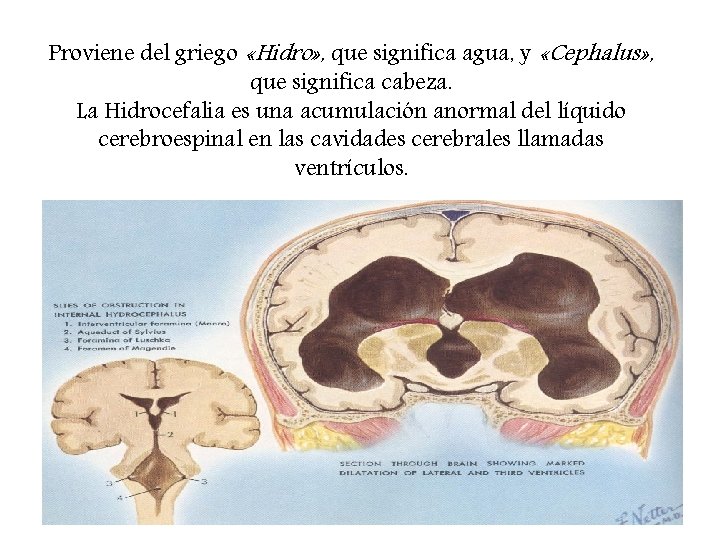 Proviene del griego «Hidro» , que significa agua, y «Cephalus» , que significa cabeza. Proviene del griego «Hidro» , que significa agua, y «Cephalus» , que significa cabeza.