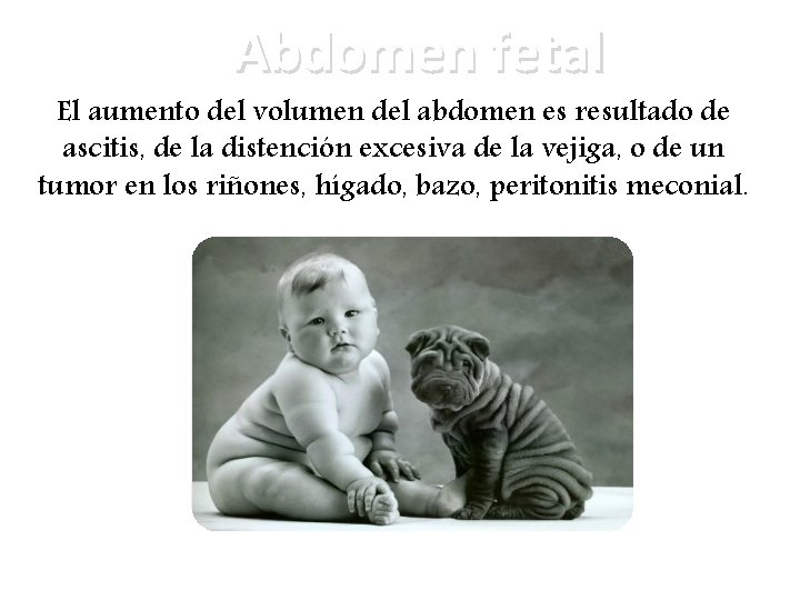Abdomen fetal El aumento del volumen del abdomen es resultado de ascitis, de la Abdomen fetal El aumento del volumen del abdomen es resultado de ascitis, de la