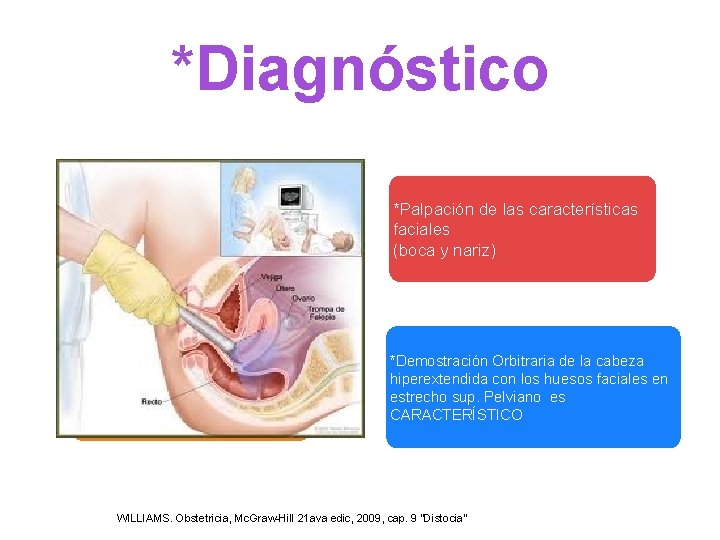 *Diagnóstico *Examen Vaginal *Huesos malares y rebordes orbitarios *Palpación de las características faciales (boca *Diagnóstico *Examen Vaginal *Huesos malares y rebordes orbitarios *Palpación de las características faciales (boca