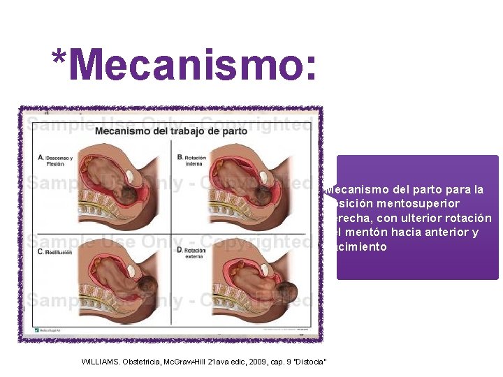 *Mecanismo: Mecanismo del parto para la posición mentosuperior derecha, con ulterior rotación del mentón *Mecanismo: Mecanismo del parto para la posición mentosuperior derecha, con ulterior rotación del mentón