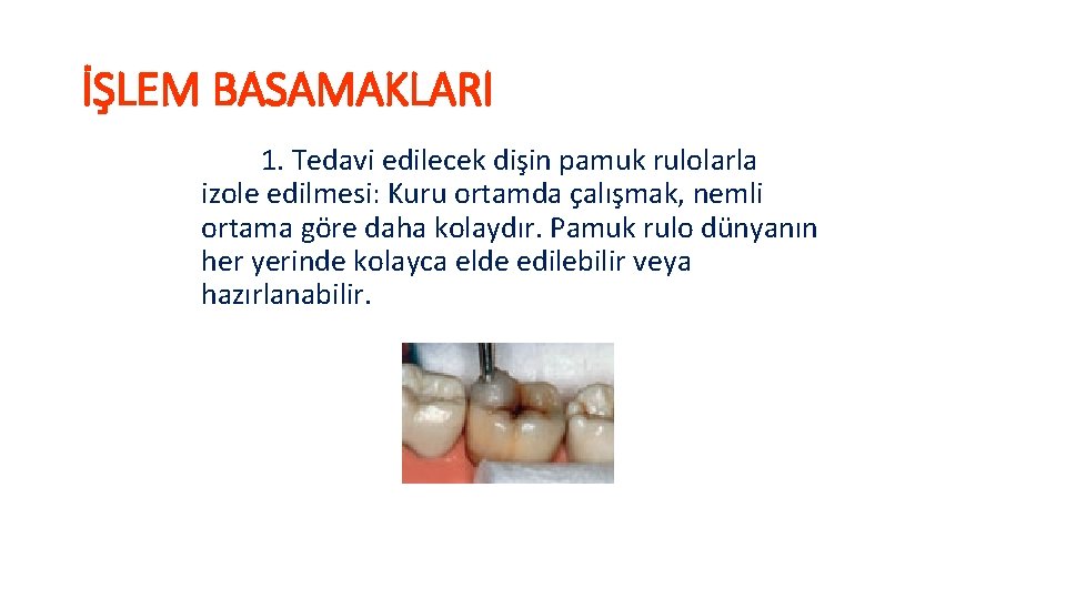 İŞLEM BASAMAKLARI 1. Tedavi edilecek dişin pamuk rulolarla izole edilmesi: Kuru ortamda çalışmak, nemli