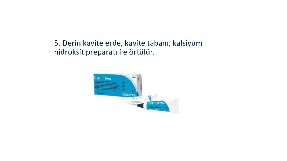 5. Derin kavitelerde, kavite tabanı, kalsiyum hidroksit preparatı ile örtülür. 
