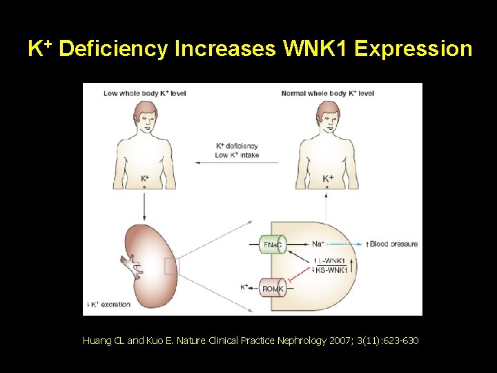 K+ Deficiency Increases WNK 1 Expression Huang CL and Kuo E. Nature Clinical Practice
