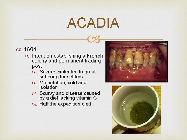 ACADIA 1604 Intent on establishing a French colony and permanent trading post Severe winter ACADIA 1604 Intent on establishing a French colony and permanent trading post Severe winter