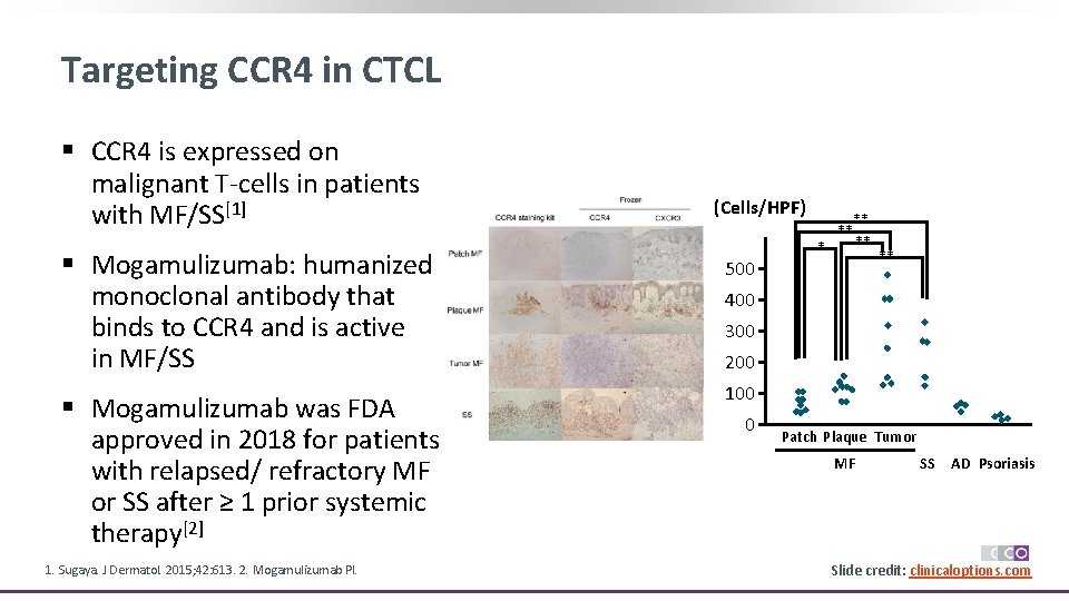Targeting CCR 4 in CTCL § CCR 4 is expressed on malignant T-cells in