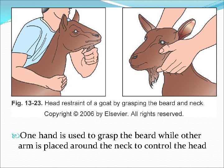  One hand is used to grasp the beard while other arm is placed