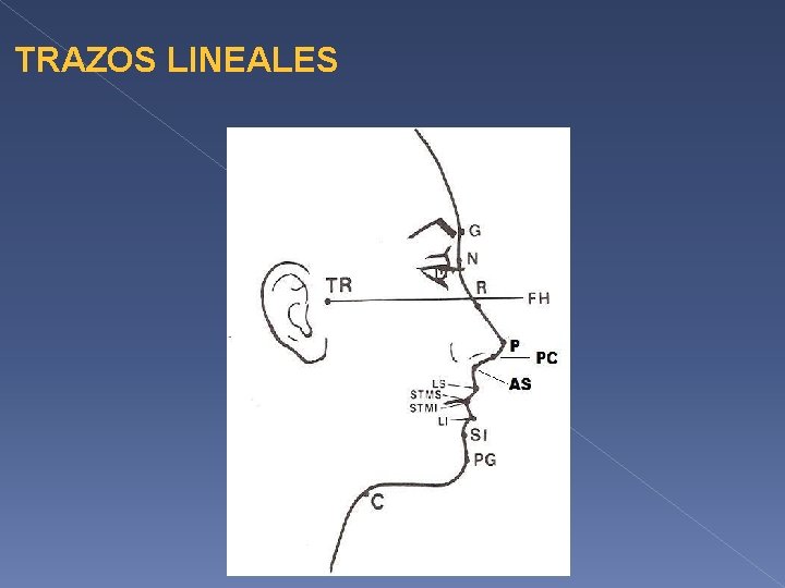 TRAZOS LINEALES CCG 