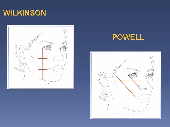 WILKINSON POWELL WILKINSON POWELL