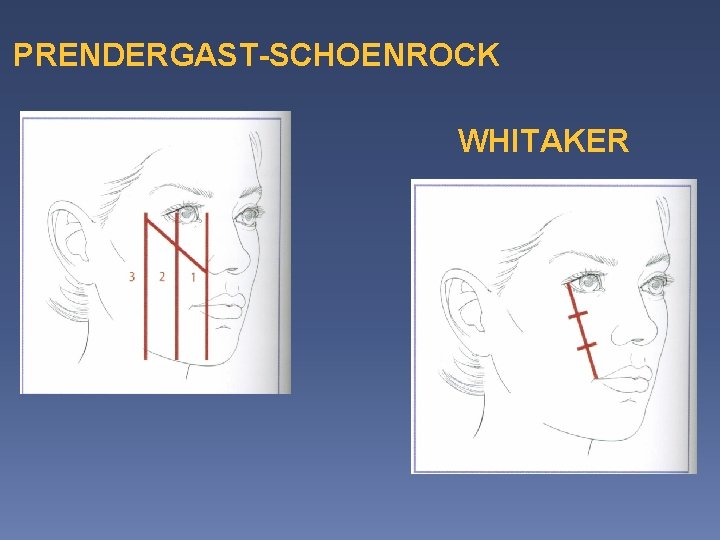 PRENDERGAST-SCHOENROCK WHITAKER 