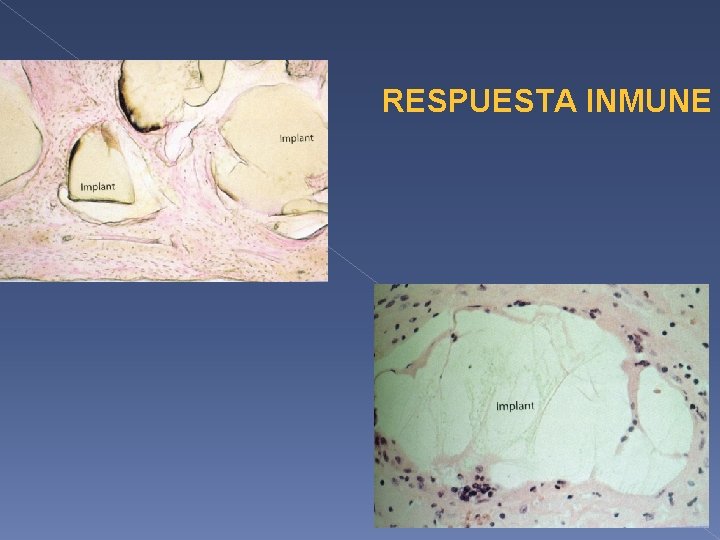 RESPUESTA INMUNE RESPUESTA INMUNE