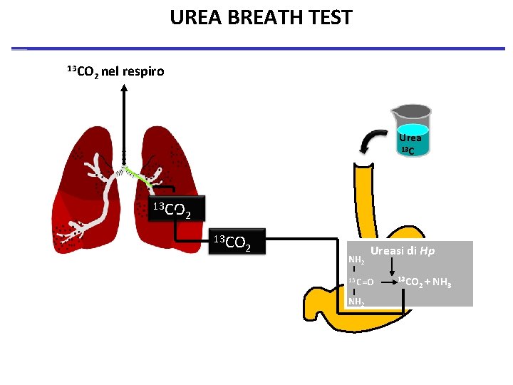 UREA BREATH TEST 13 CO 2 nel respiro Urea 13 CO 2 NH 2