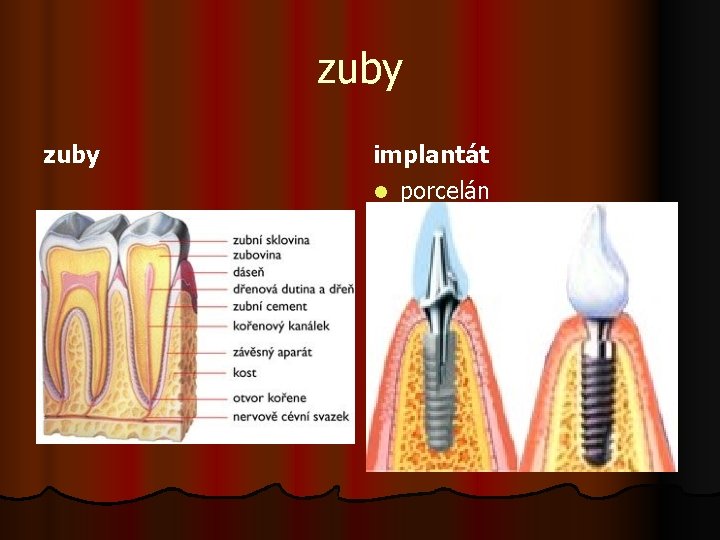 zuby implantát l porcelán 