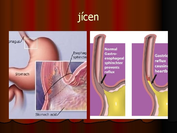 jícen 