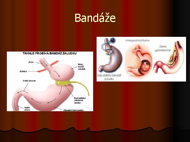 Bandáže 