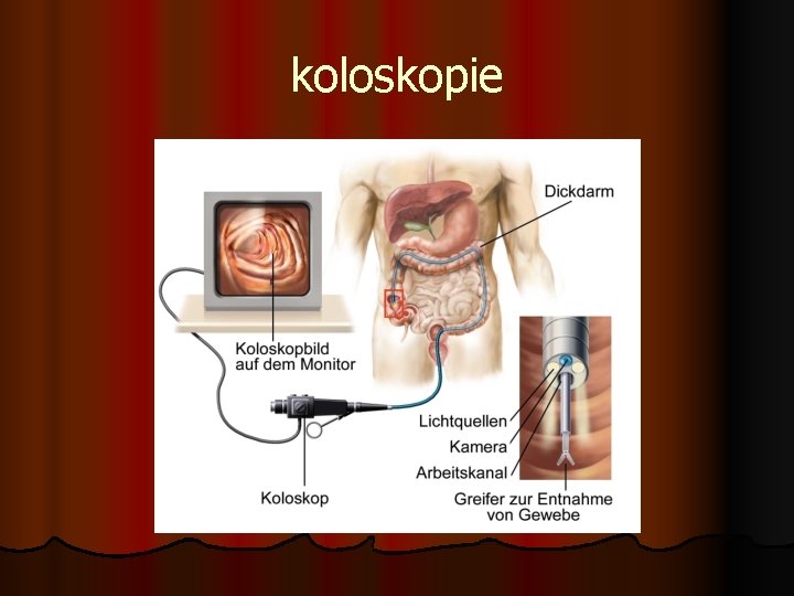 koloskopie 