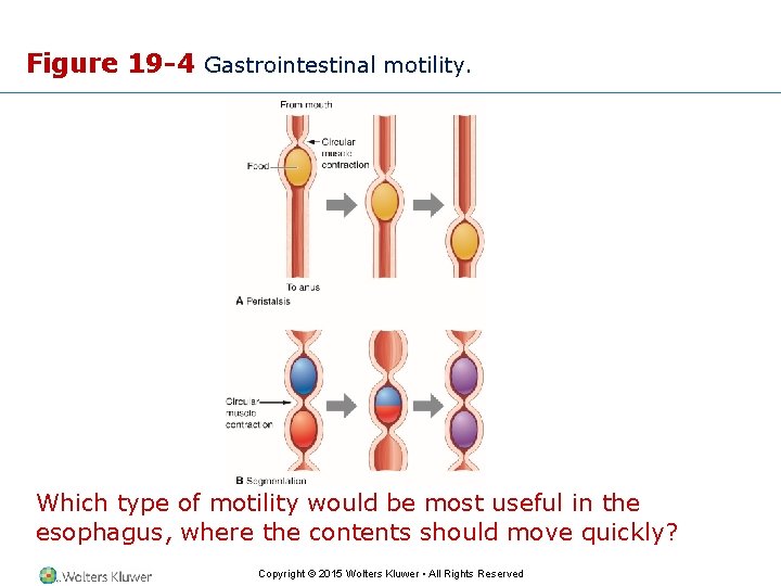 Figure 19 -4 Gastrointestinal motility. Which type of motility would be most useful in