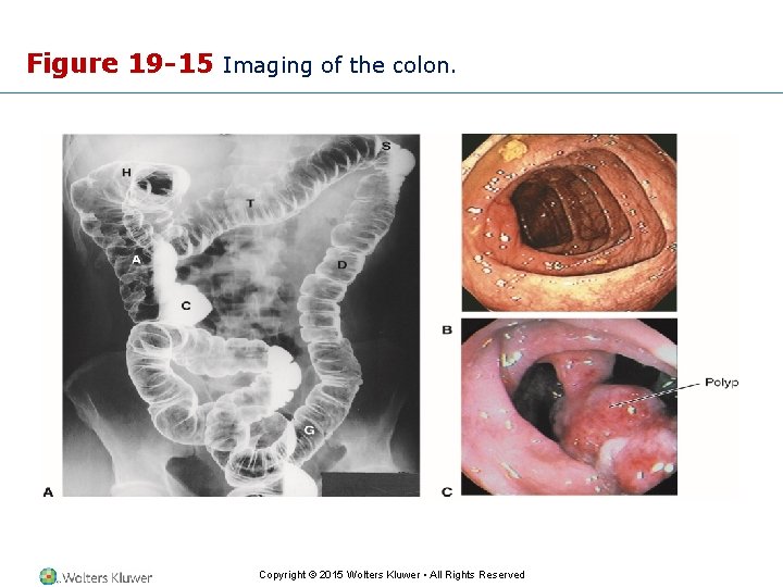 Figure 19 -15 Imaging of the colon. Copyright © 2015 Wolters Kluwer • All