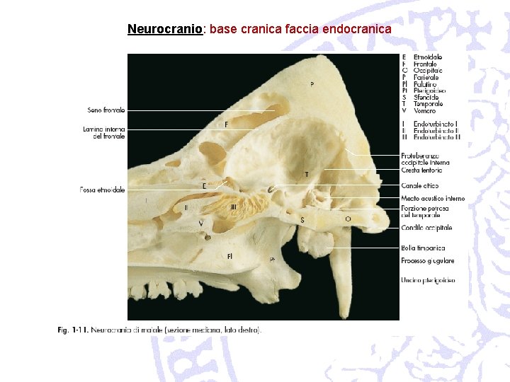 Neurocranio: base cranica faccia endocranica 