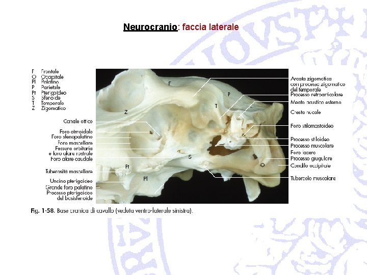 Neurocranio: faccia laterale 