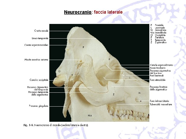 Neurocranio: faccia laterale 