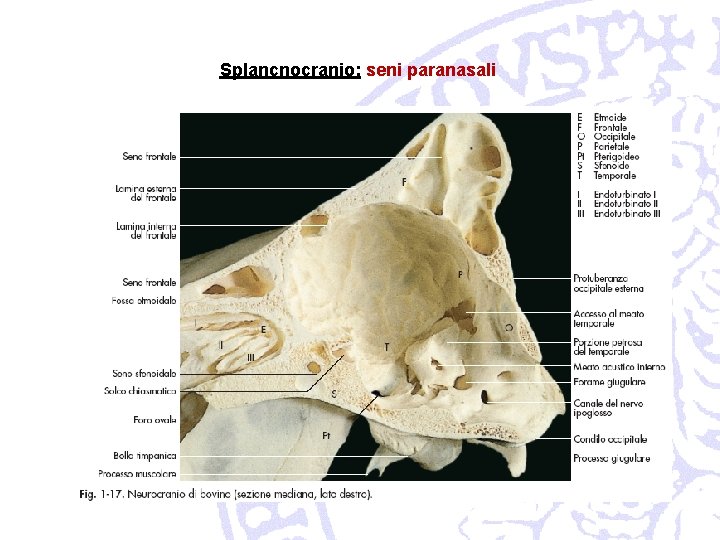 Splancnocranio: seni paranasali 