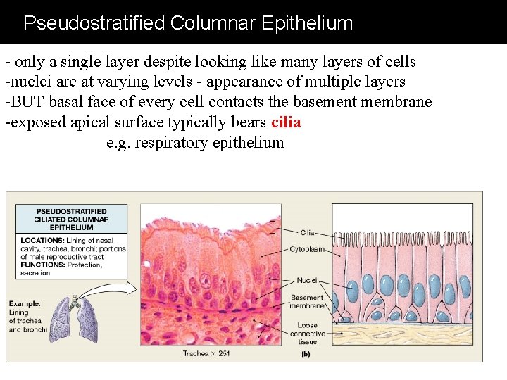 Pseudostratified Columnar Epithelium - only a single layer despite looking like many layers of