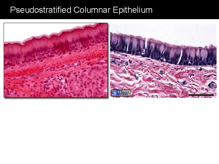 Pseudostratified Columnar Epithelium 