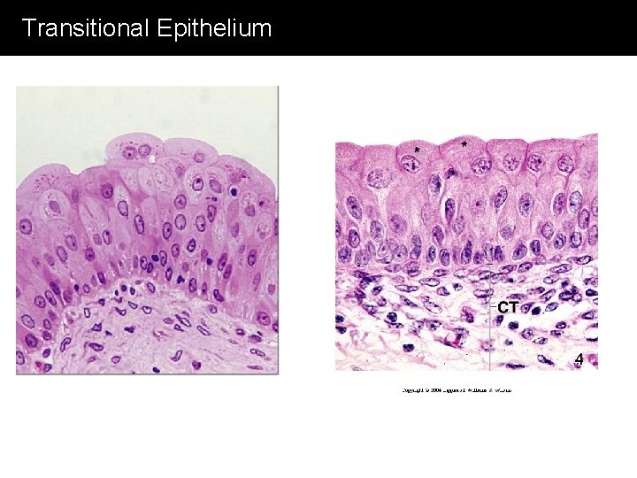 Transitional Epithelium 