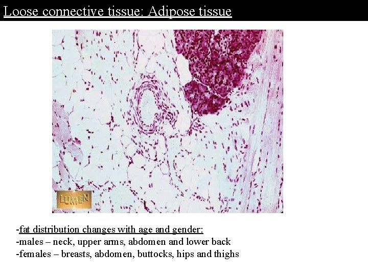 Loose connective tissue: Adipose tissue -fat distribution changes with age and gender: -males –