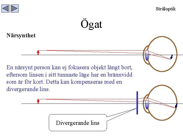 Stråloptik Ögat Närsynthet En närsynt person kan ej fokusera objekt långt bort, eftersom linsen