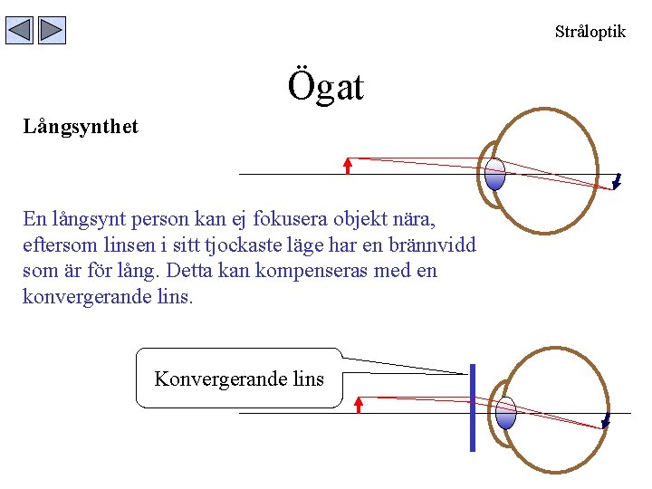 Stråloptik Ögat Långsynthet En långsynt person kan ej fokusera objekt nära, eftersom linsen i