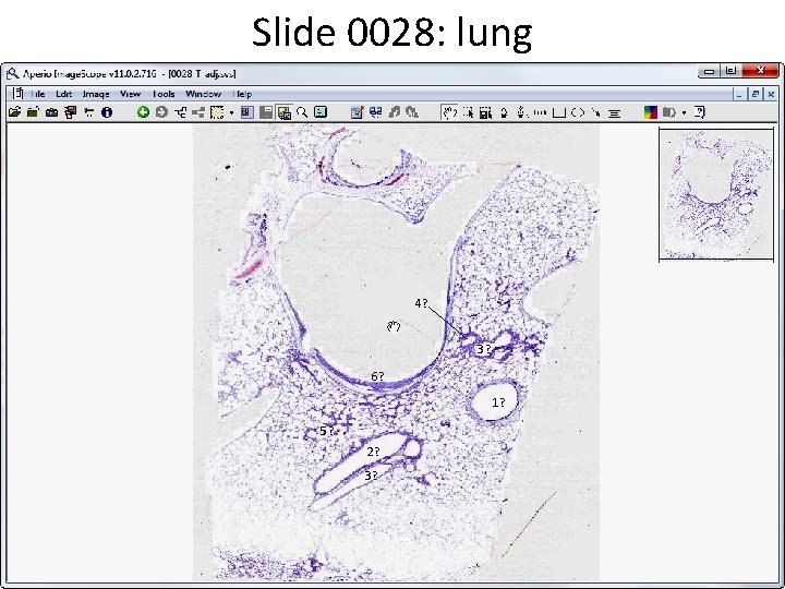 Slide 0028: lung 4? 3? 6? 1? 5? 2? 3? 