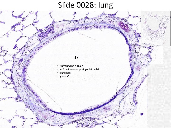 Slide 0028: lung 1? • • surrounding tissue? epithelium – simple? goblet cells? cartilage?