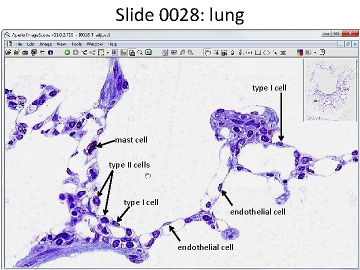 Slide 0028: lung type I cell mast cell type II cells type I cell