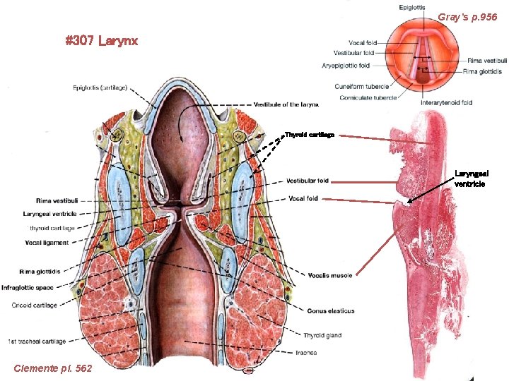 Gray’s p. 956 #307 Larynx Thyroid cartilage Laryngeal ventricle Clemente pl. 562 