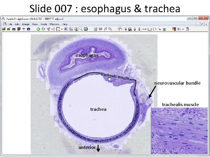 Slide 007 : esophagus & trachea esophagus trachea l is musc l trachea anterior