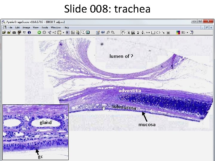 Slide 008: trachea lumen of ? adventitia submucosa gland gc mucosa 