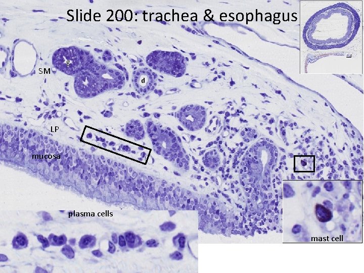 Slide 200: trachea & esophagus SM g d LP mucosa plasma cells mast cell