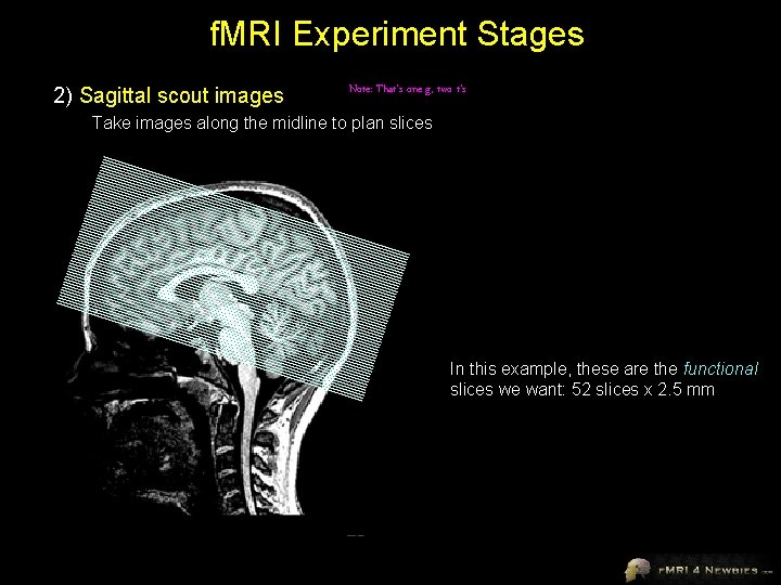 f. MRI Experiment Stages 2) Sagittal scout images Note: That’s one g, two t’s