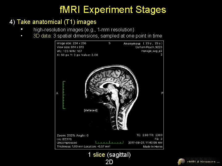 f. MRI Experiment Stages 4) Take anatomical (T 1) images • high-resolution images (e.