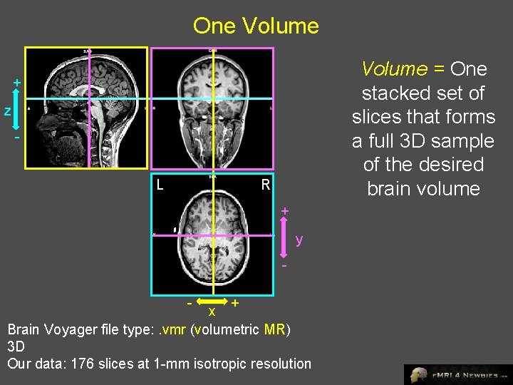 One Volume = One stacked set of slices that forms a full 3 D