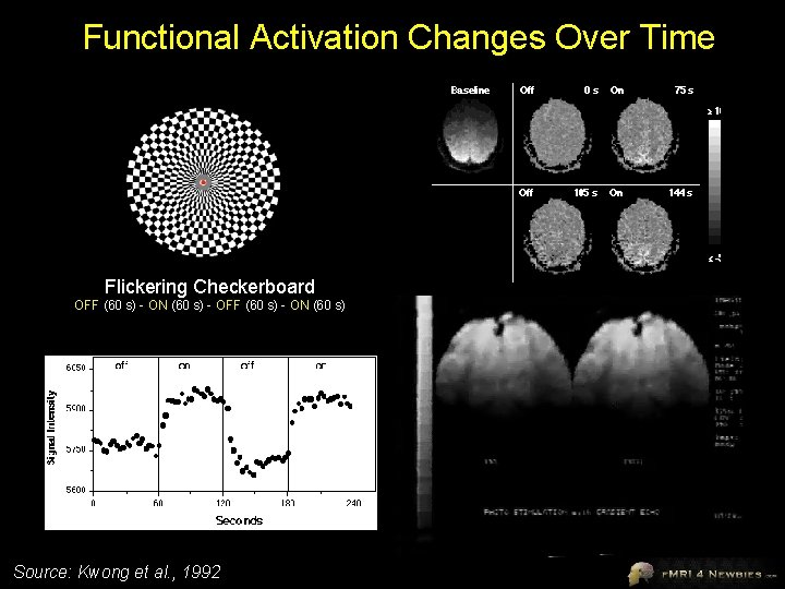 Functional Activation Changes Over Time Flickering Checkerboard OFF (60 s) - ON (60 s)