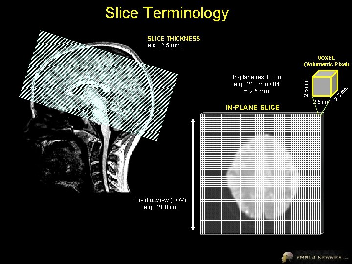 Slice Terminology SLICE THICKNESS e. g. , 2. 5 mm IN-PLANE SLICE Field of