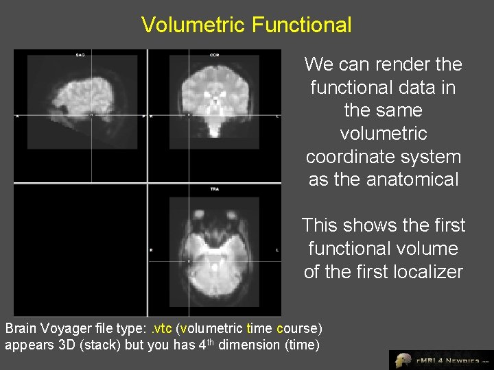 Volumetric Functional We can render the functional data in the same volumetric coordinate system