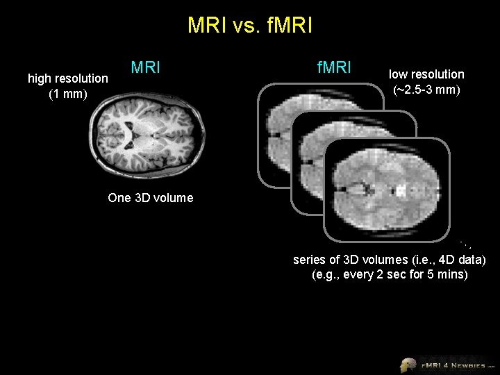 MRI vs. f. MRI high resolution (1 mm) MRI f. MRI low resolution (~2.