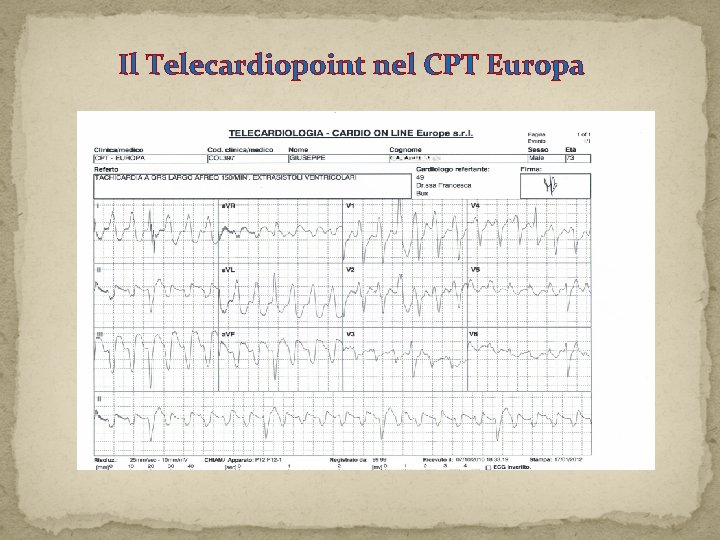 Il Telecardiopoint nel CPT Europa Il Telecardiopoint nel CPT Europa