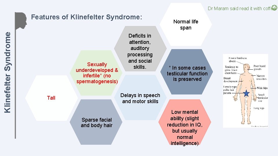 Dr Maram said read it with coffee Klinefelter Syndrome Features of Klinefelter Syndrome: Sexually