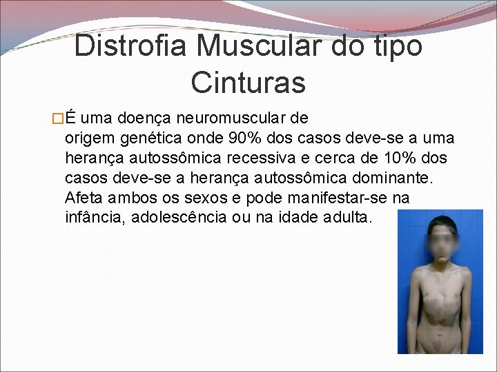 Distrofia Muscular do tipo Cinturas �É uma doença neuromuscular de origem genética onde 90%