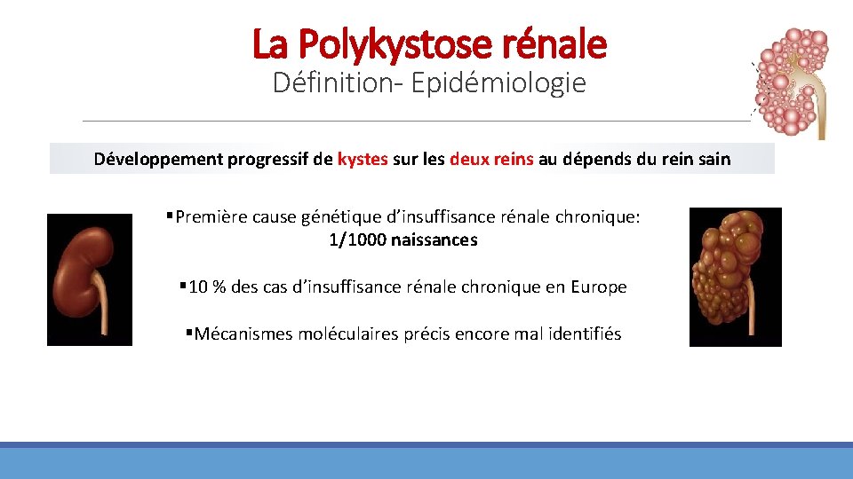 La Polykystose rénale Définition- Epidémiologie Développement progressif de kystes sur les deux reins au